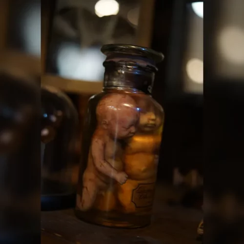 La Taverne De Platon Cabinet De Curiosites Aix En Provence 05 Foetus Siamois Silicone